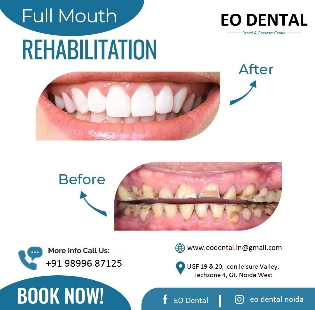 EO Dental